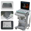 3D Laptop Ultrasound Scanner